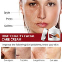 Brightening Niacinamide Cream for Aging