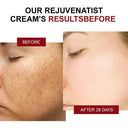 Brightening Niacinamide Cream for Aging