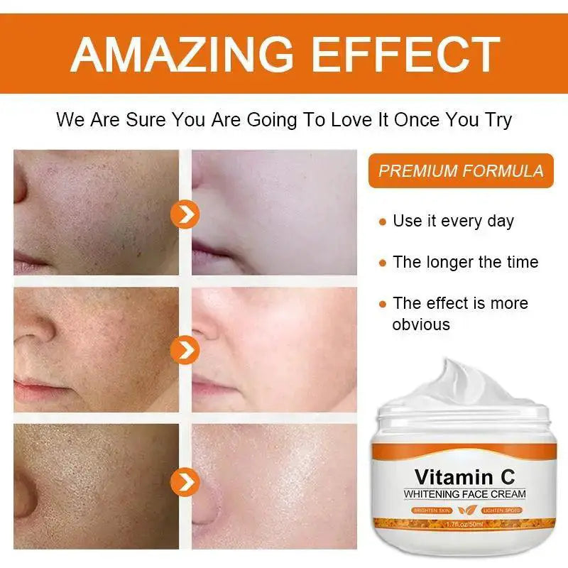 Radiant Glow Vitamin C Dark Spot Cream For Youthful Skin