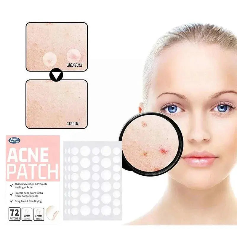 Advanced Hydrocolloid Acne Healing Patches For Clear Skin