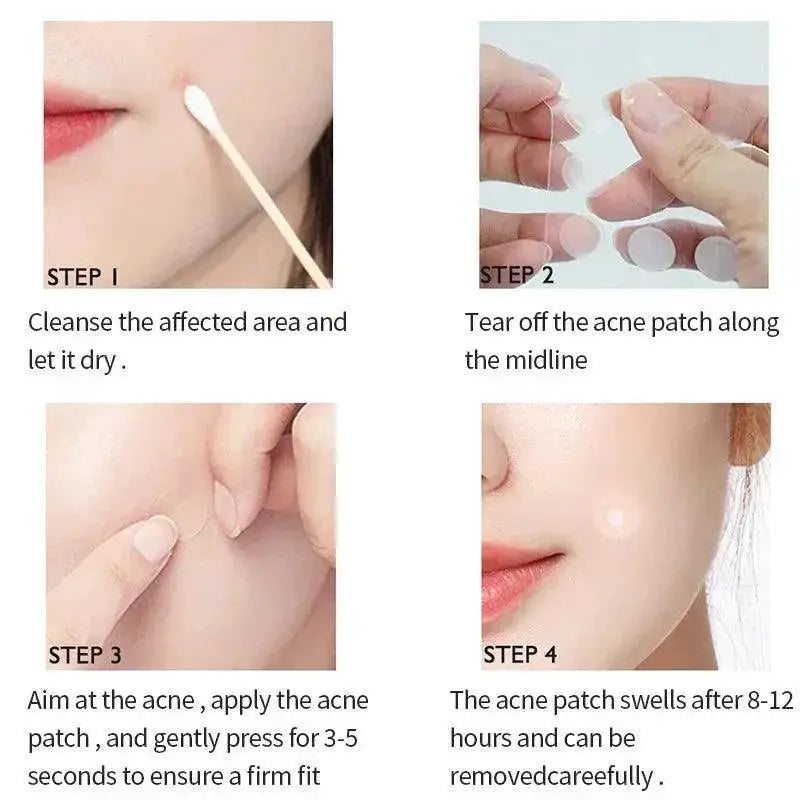 Advanced Hydrocolloid Acne Healing Patches For Clear Skin