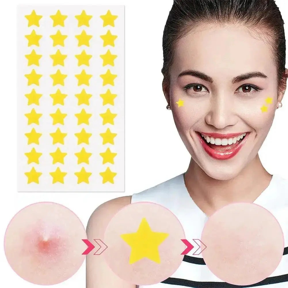 Clear Skin Adhesive Acne Patches With Stylish Designs