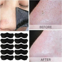 Oil Control Pore Peel For Oily Skin