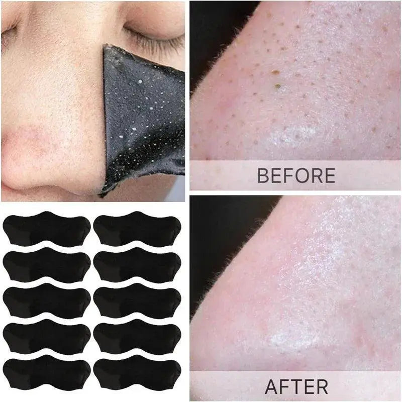 Ultimate Blackhead Removal Peel Mask And Pore Cleansing Kit