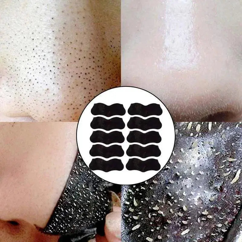 Ultimate Blackhead Removal Peel Mask And Pore Cleansing Kit