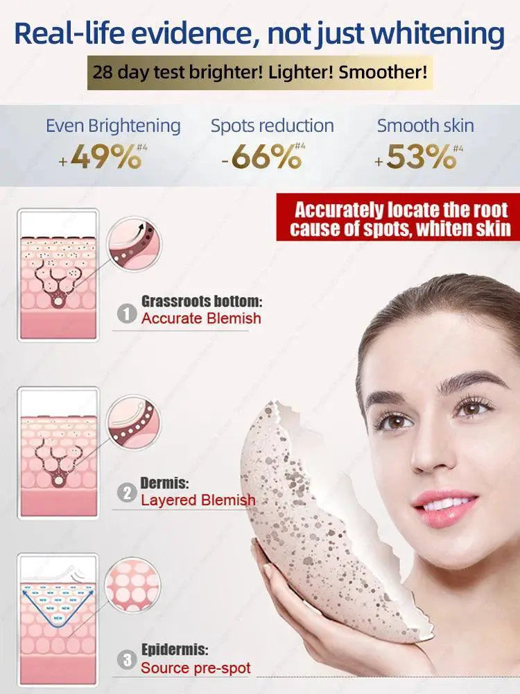 Spotless Complexion Dark Spot Remover Cream For Melasma