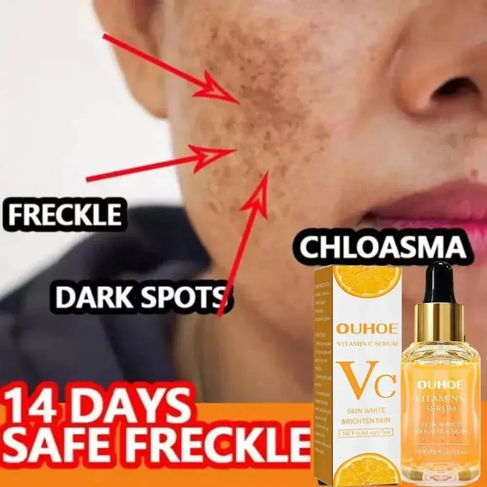 Vitamin C Serum For Anti Wrinkle Radiant Glow Youthful Skin