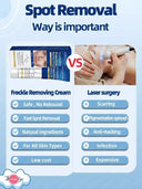 Spot Correcting Cream for Melasma Care