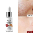 Youthful Glow Niacinamide Serum Advanced Anti Aging Skincare