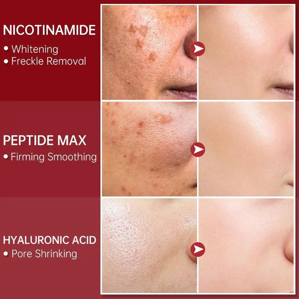 Youthful Glow Niacinamide Serum Advanced Anti Aging Skincare