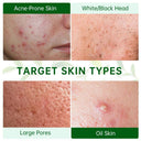Tea Tree Clay Mask For Acne And Clear Skin 50ml Daily Use