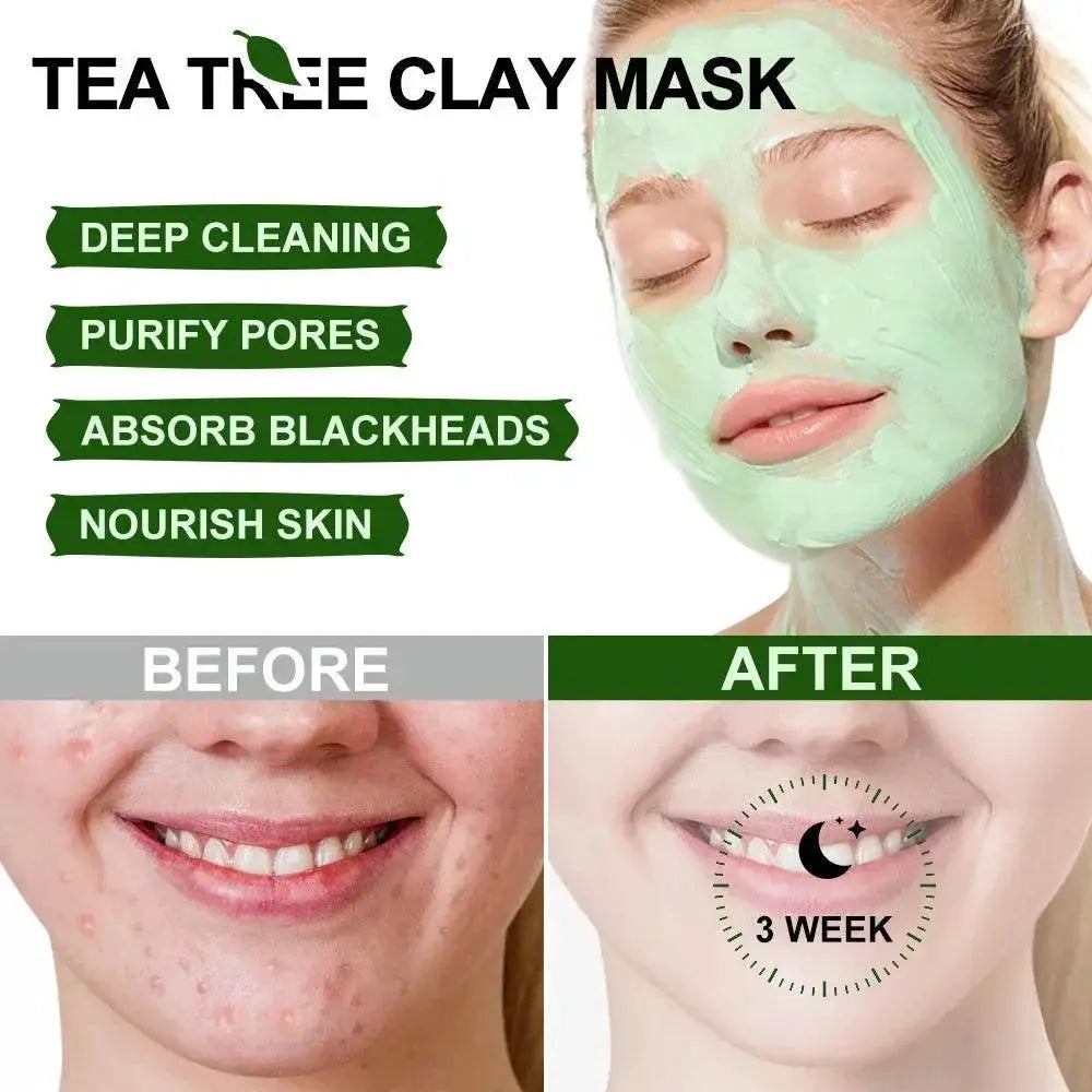Tea Tree Clay Mask For Acne And Clear Skin 50ml Daily Use