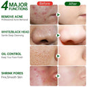 Tea Tree Clay Mask For Acne And Clear Skin 50ml Daily Use