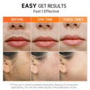 Painless Hair Removal Cream for Skin