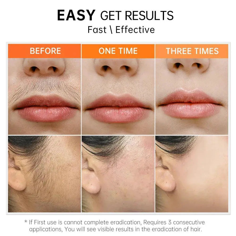 Smooth Skin Hair Removal Cream Gentle Formula 50ml
