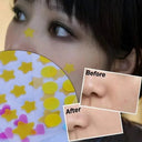 Star Acne Patch Stickers For Clear Skin And Quick Healing