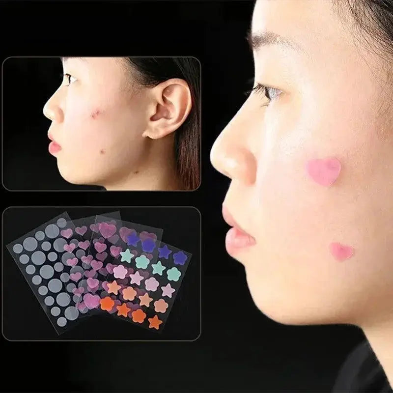 Star Acne Patch Stickers For Clear Skin And Quick Healing