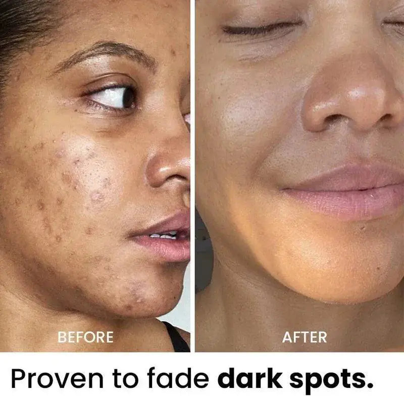 Turmeric Clay Mask For Radiant Skin Anti Wrinkle Formula