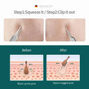 Clear Skin Blackhead Extractor Kit Home