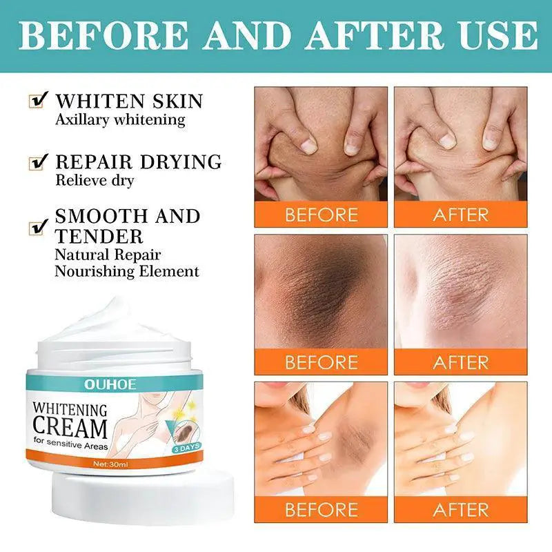 Brighten Up Skin Whitening Gel For Women Underarms And Legs