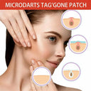 Acne Master Hydrocolloid Patches For 24 Hour Healing