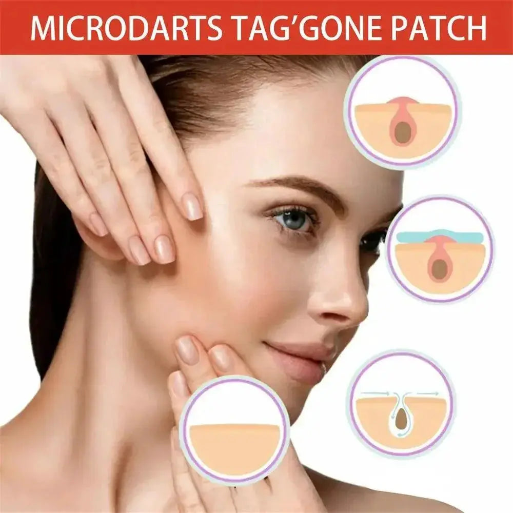 Acne Master Hydrocolloid Patches For 24 Hour Healing