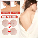 Acne Master Hydrocolloid Patches For 24 Hour Healing