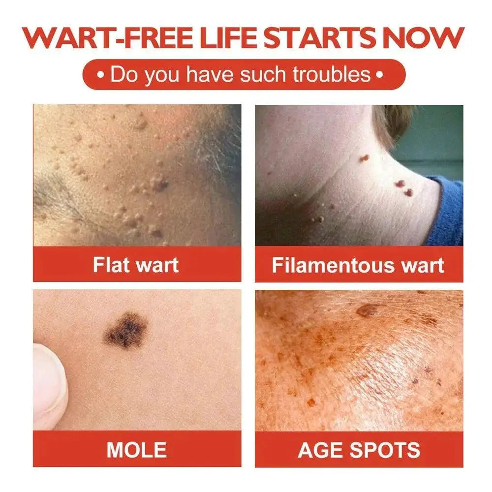 Acne Master Hydrocolloid Patches For 24 Hour Healing