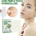 Acne Scar Prevention Hydrocolloid Patches For Fast Recovery