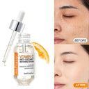 Vitamin C Serum for Skin Brightening
