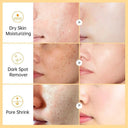 Vitamin C Serum for Skin Brightening