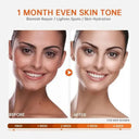 Vitamin C Serum for Skin Brightening