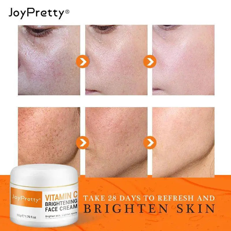 Vitamin C Brightening Face Cream for Dark Spots Removal