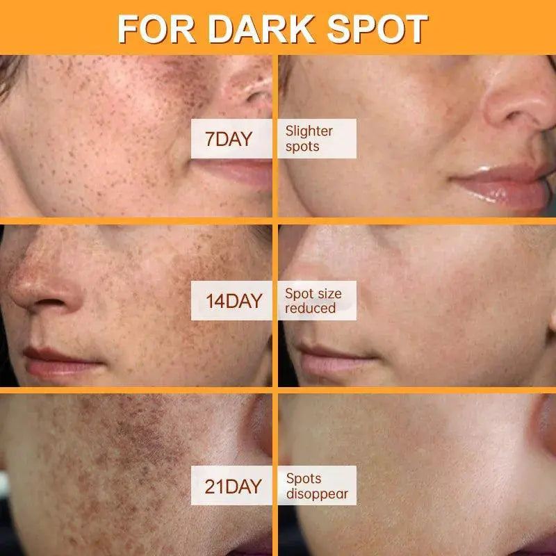 Vitamin C Brightening Face Cream for Dark Spots Removal
