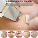Ultrasonic Skin Scrubber for Deep Cleansing and Radiant Skin