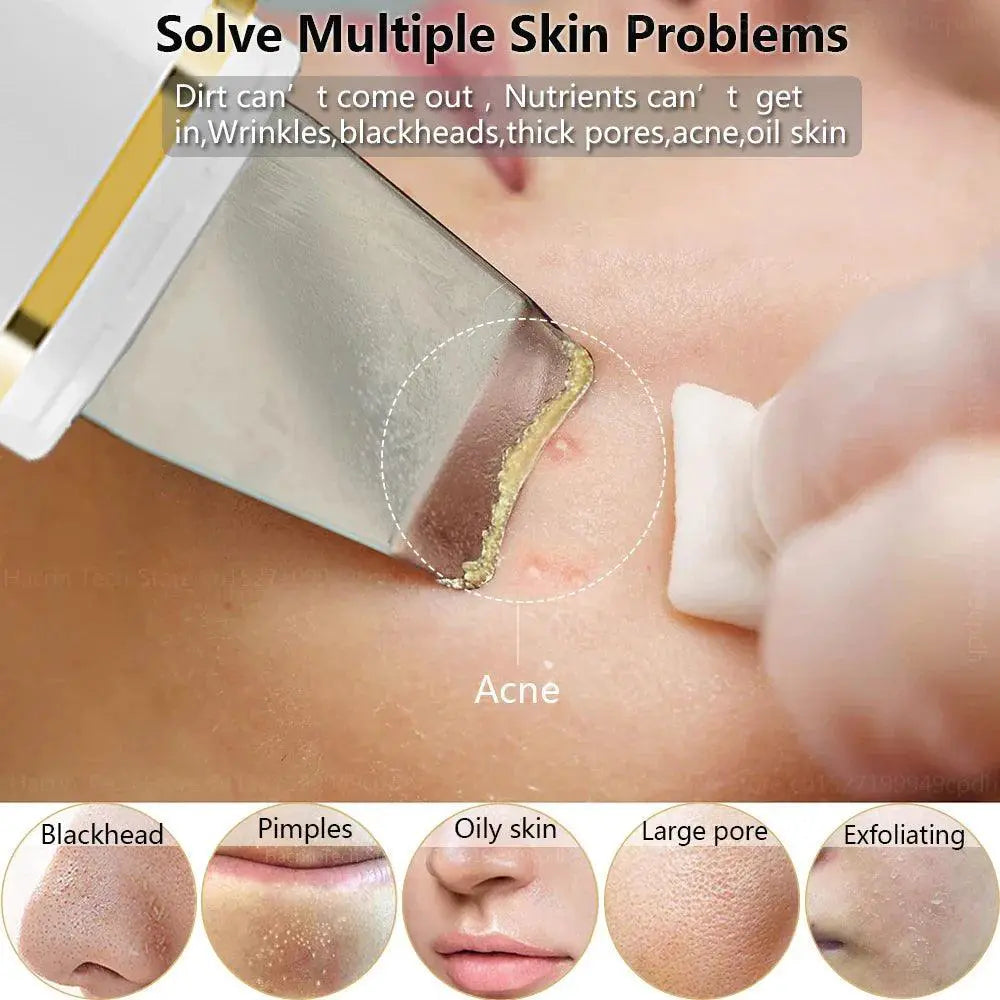 Ultrasonic Skin Scrubber for Deep Cleansing and Radiant Skin