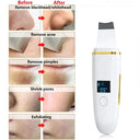 Ultrasonic Skin Scrubber for Deep Cleansing and Radiant Skin