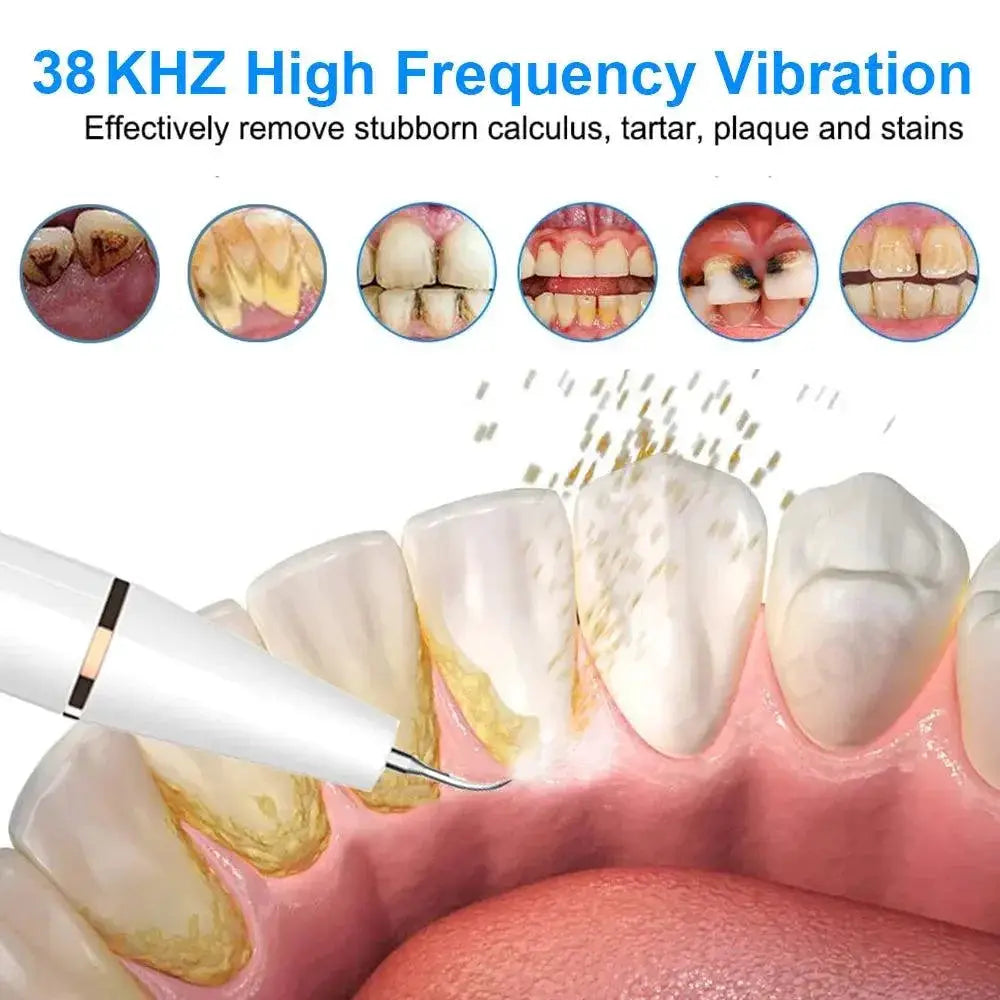 Ultrasonic Dental Scaler Tartar Removal Kit For Home Use