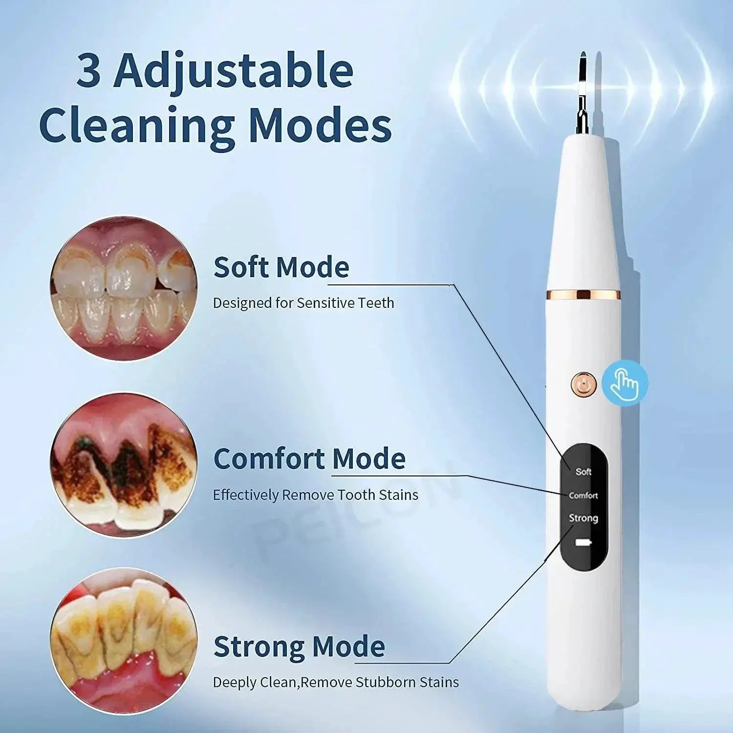 Ultrasonic Dental Scaler Tartar Removal Kit For Home Use