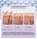 Pain-Free Hair Removal IPL Device Home