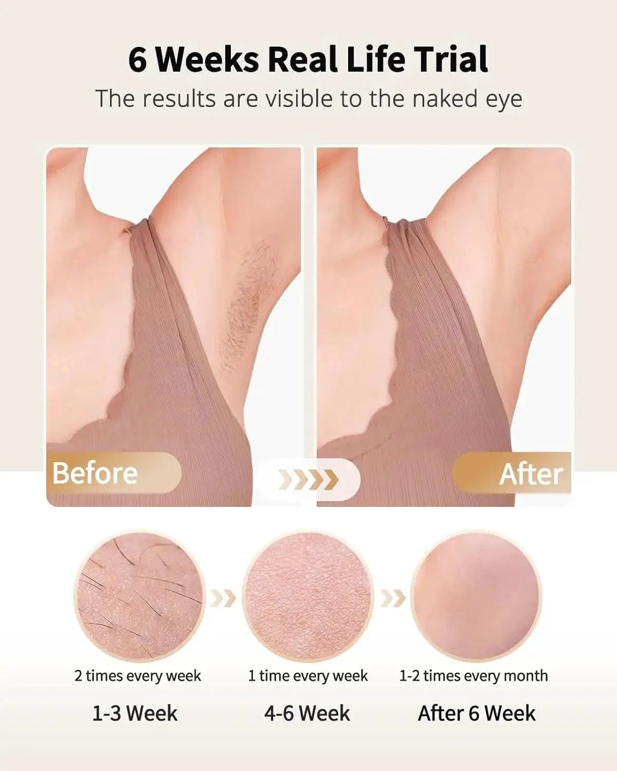 Pain-Free IPL Epilator for Home Use