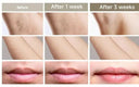 Pain-Free IPL Hair Removal Device for Women