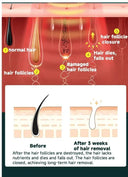 Pain-Free IPL Hair Removal Device for Women