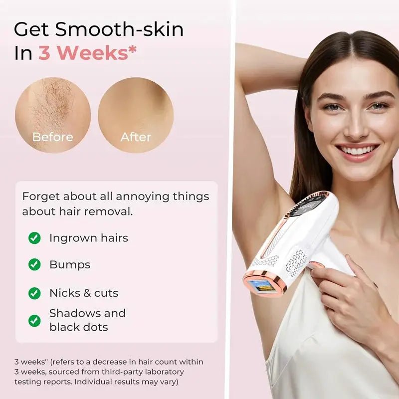 Pain-Free IPL Hair Removal Device for Women