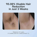 Pain-Free IPL Hair Removal for Home Use