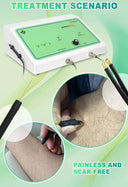 Painless Epilator For Home Grooming