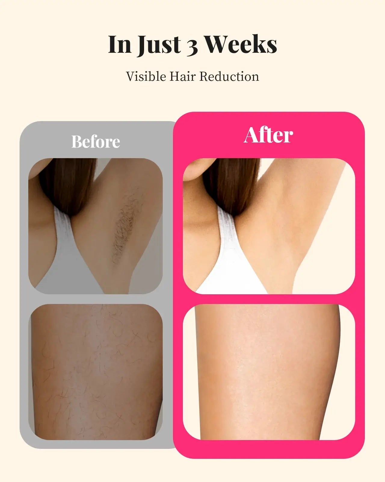 Painless Home IPL Hair Removal Device