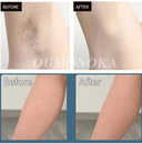 Painless IPL Epilator for Women at Home