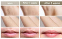 Painless IPL Epilator for Women at Home