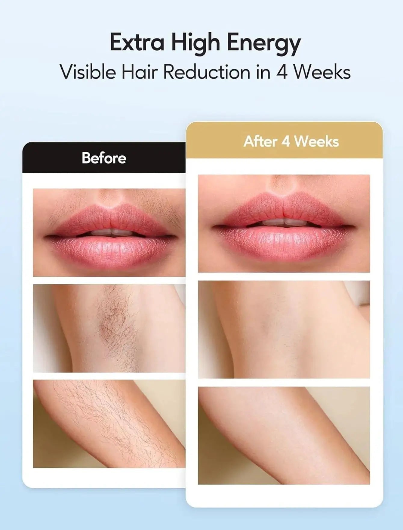Painless IPL Hair Removal for Women